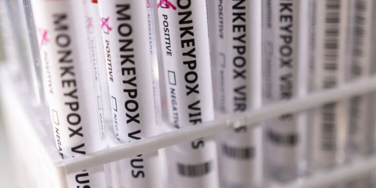 Privado: São Paulo confirma primeiro caso de varíola dos macacos no Brasil