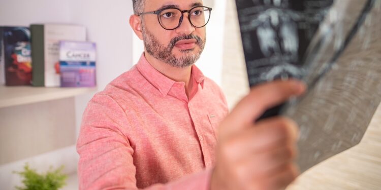 Commonike saúde: Câncer de Cólon: médico do Cariri explica sobre doença que causou a morte de Pelé