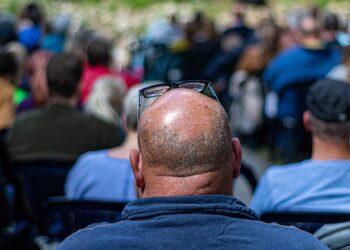 Terapia capilar evita queda dos fios e previne calvície