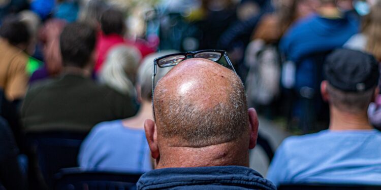 Terapia capilar evita queda dos fios e previne calvície