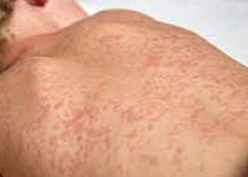 Crato participa de busca ativa e “Dia S” de combate ao sarampo