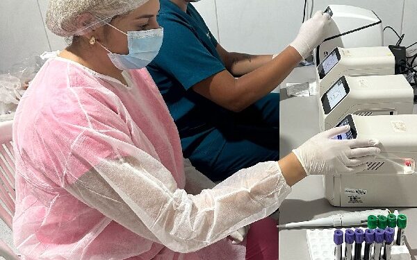USF Vila Nova contabiliza mais de 2 mil exames realizados através do Laboratório Descentralizado