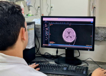 Saiba hábitos que podem afetar a saúde do cérebro; HRC orienta sobre prevenção de doenças neurológicas